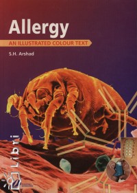 S. H. Arshad - Allergy