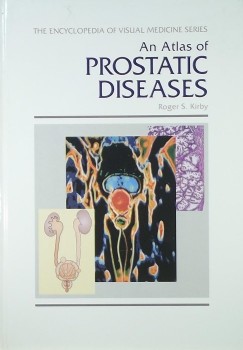 Roger Sinclair Kirby - An Atlas of Prostatic Diseases
