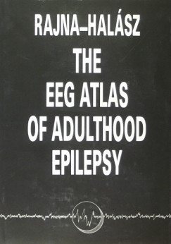 Dr. Halsz Pter - The EEG atlas of adulthood epilepsy