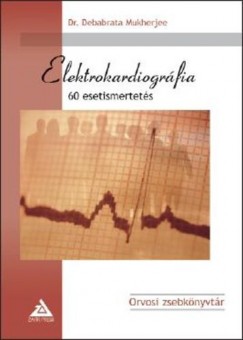 Dr. Debabrata Mukherjee - Elektrokardiogrfia - 60 esetismertets