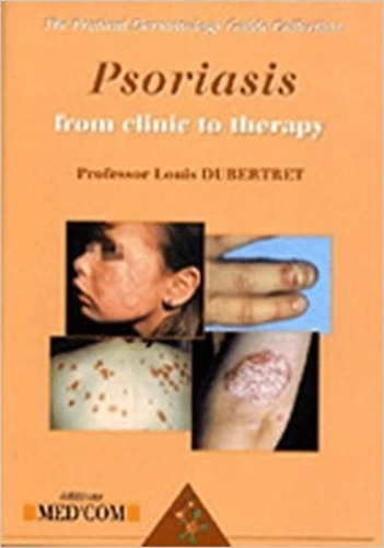 Psoriasis: From Clinic To Therapy