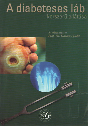 A diabeteses lb korszer elltsa