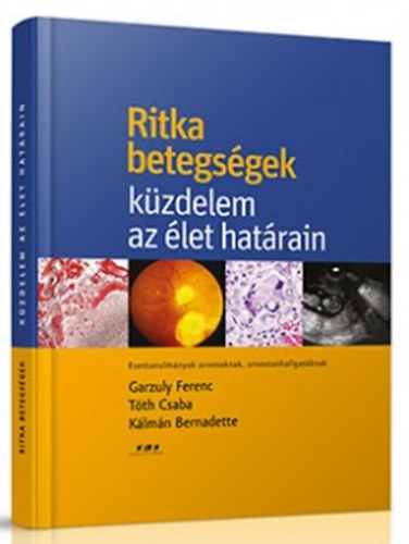 Garzuly Ferenc; Tth Csaba; Klmn Bernadette - Ritka betegsgek