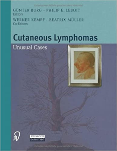 Cutaneous Lymphomas - Unusual Cases