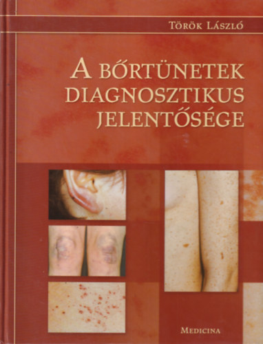 A brtnetek diagnosztikus jelentsge