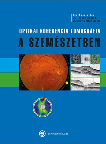 Optikai koherencia tomogr�fia a szem�szetben