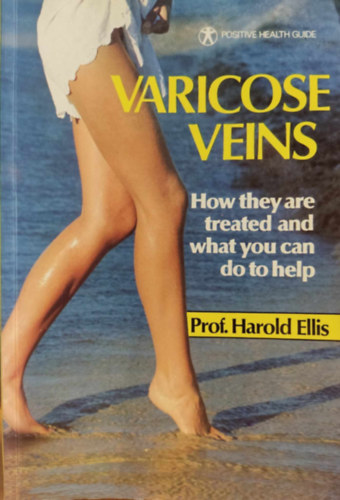 Varicose Veins: How they are treated and what you can do to help (Positive Health Guide)