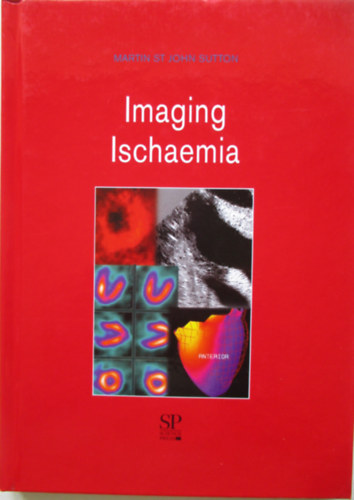 Imaging ischaemia