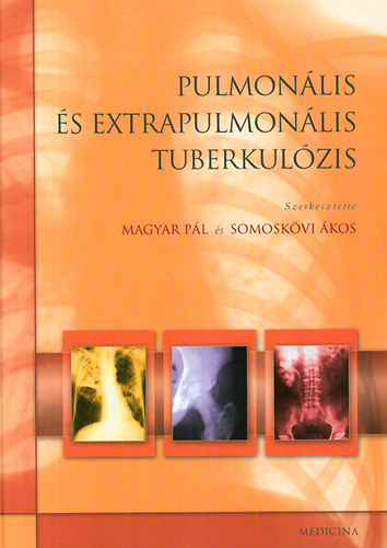 Somoskvi kos  (szerk.); Magyar Pl (szerk.) - Pulmonlis s extrapulmonlis tuberkulzis