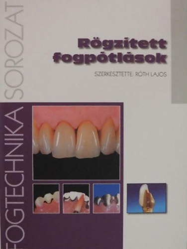 R�gz�tett fogp�tl�sok