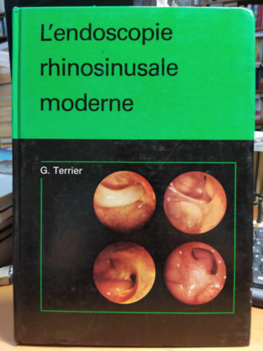 L'endoscopie rhinosinusale moderne