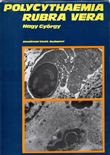 Dr. Nagy Gyrgy - Polycythaemia Rubra Vera klinikuma, pathologija s korszer kezelse
