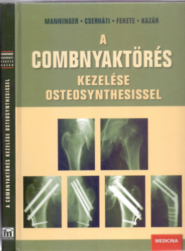A combnyaktrs kezelse osteosynthesissel (Dediklt)