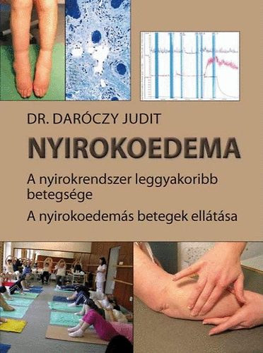 Nyirokoedema - A nyirokrendszer leggyakoribb betegs�ge