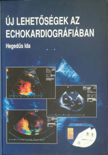 �j lehet�s�gek az echokardiogr�fi�ban