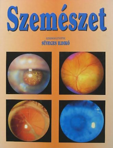 Szemszet