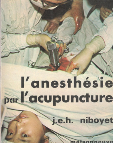 J.E.H. Niboyet - L'anesth�sie par l'acupuncture