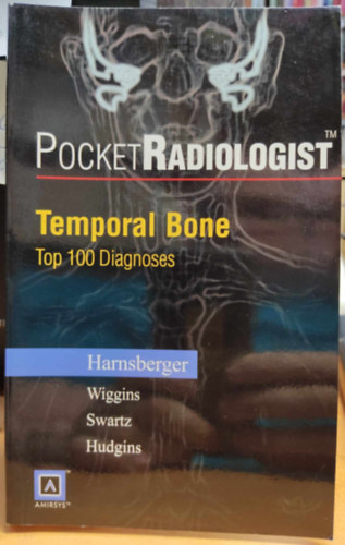 Pocket Radiologist: Temporal Bone - Top 100 Diagnoses
