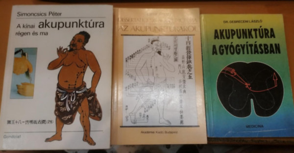 3 db Akupunktra a gygytsban + Dissertatio de acupunctura az akupunktrrl + A knai akupunktra rgen s ma
