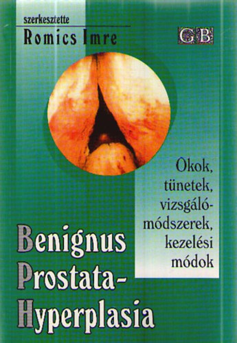Benignus prostatahyperplasia