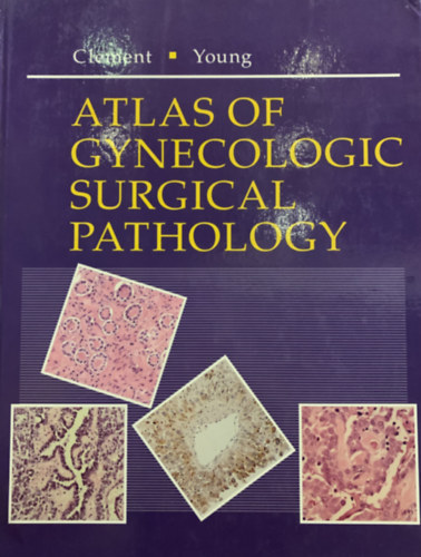 Atlas of Gynecologic Surgical Pathology