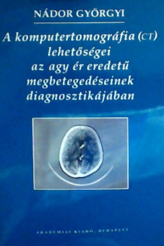 A komputertomogrfia (CT) lehetsgei az agy r eredet megbetegedseinek diagnosztikjban