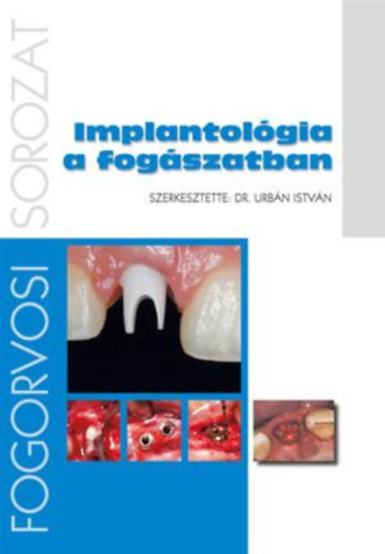 Urbn Istvn dr. szerk. - Implantolgia a fogszatban