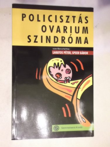 Policiszts ovarium szindrma