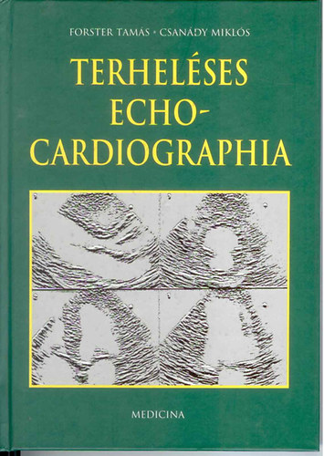Terhelses echocardiographia