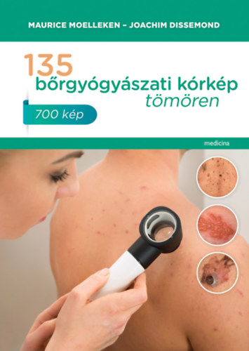 135 brgygyszati krkp tmren - 700 kp