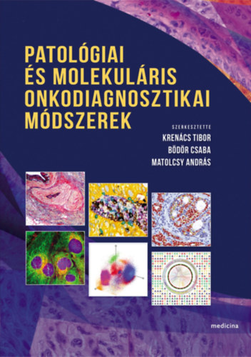 Bödör Csaba (szerk.), Matolcsy András (szerk.) Krenács Tibor (szerk.) - Patológiai és molekuláris onkodiagnosztikai módszerek