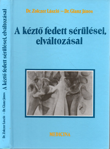 Glanz János Zolczer László - A kéztő fedett sérülései, elváltozásai