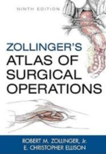 Zollinger's Atlas of Surgical Operations (Zollinger seb�szeti m�t�ti atlasza)
