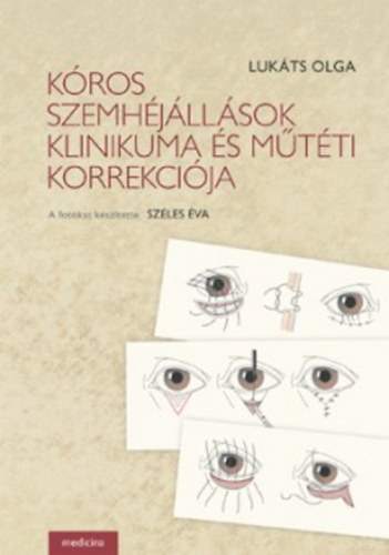Kros szemhjllsok klinikuma s mtti korrekcija
