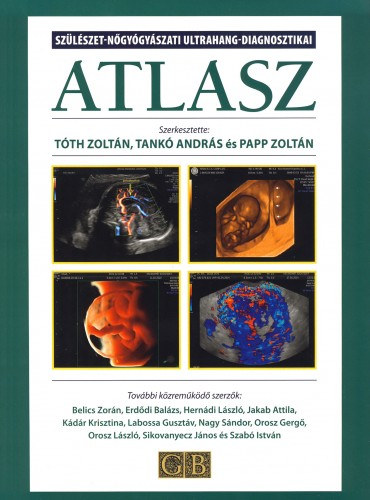 Dr. Tank Andrs, Dr. Tth Zoltn Papp Zoltn \ (szerk.) - Szlszet-ngygyszati ultrahang-diagnosztikai ATLASZ