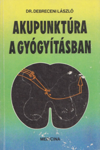 Akupunktra a gygytsban