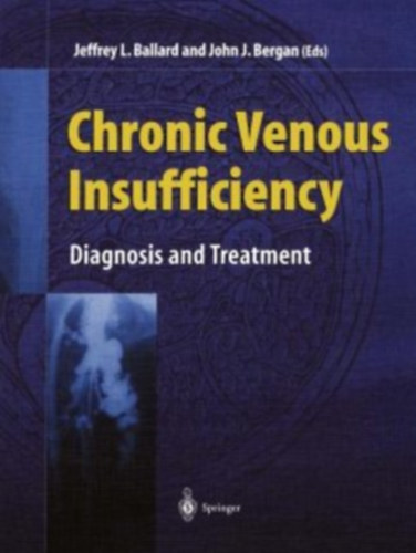 John J. Bergan Jeffrey Ballard - Chronic Venous Insufficiency: Diagnosis and Treatment