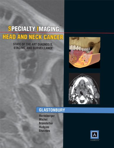 H. Ric Harnsberger, MD, Barton F. Branstetter, IV, MD, Michelle A. Michel, MD, Deborah R. Shatzkes, MD, Patricia A. Hudgins, MD Christine M. Glastonbury - Specialty Imaging Head and Neck Cancer: State of the Art Diagnosis, Staging, and Surveillance (Amirsys Publishing, Inc.)