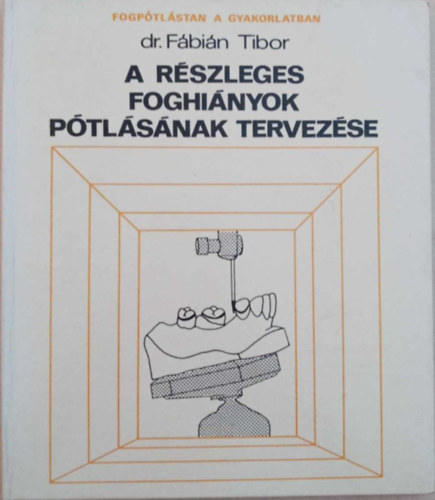 A rszleges foghinyok ptlsnak tervezse - Fogptlstan a gyakorlatban