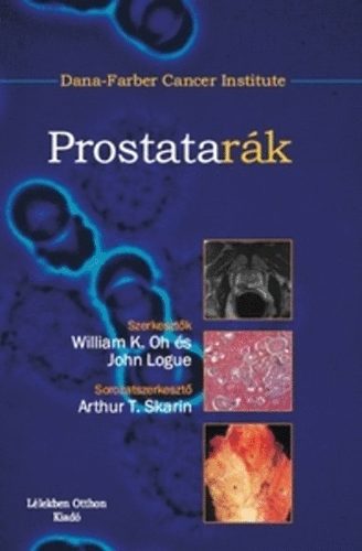 Prostatark