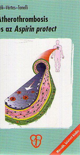 Atherothrombosis s az Aspirin protect
