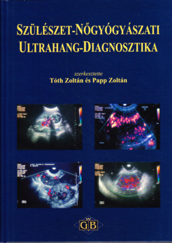 Szlszet-ngygyszat ultrahang-diagnosztika