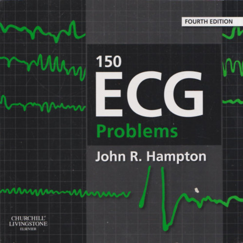 150 ECG Problems (Fourth Edition)