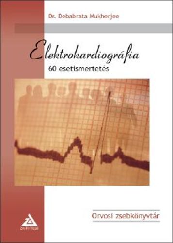 Elektrokardiogrfia - 60 esetismertets
