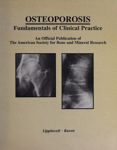 Osteoporosis - Fundamentals of Clinical Practice