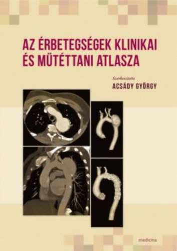 Acsdy Gyrgy; Dr. Nemes Attila - Az rbetegsgek klinikai s mtttani atlasza