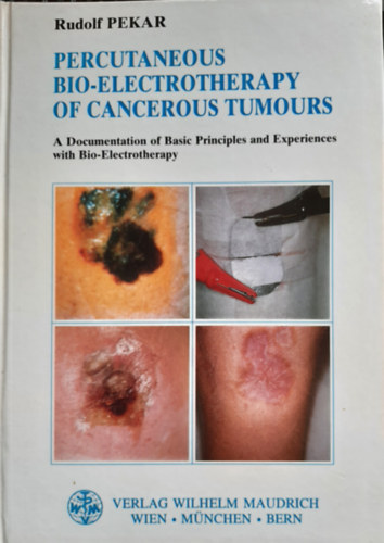 Percutaneous Bio-Electrotherapy of Cancerous Tumours: A Documentation of Basic Principles and Experiences with Bio-Electrotherapy