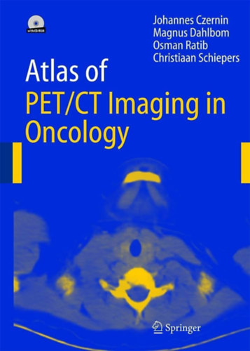 Atlas of PET/CT Imaging in Oncology + CD