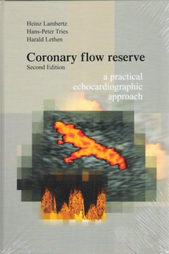 Coronary flow reserve - a practical echocardiographic approach