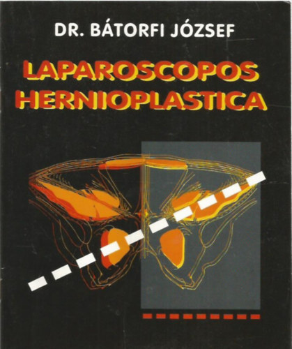 Laparoscopos Hernioplastica